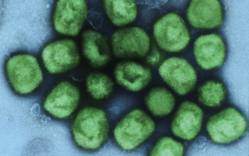Mpox, Suécia confirma o primeiro caso mais grave